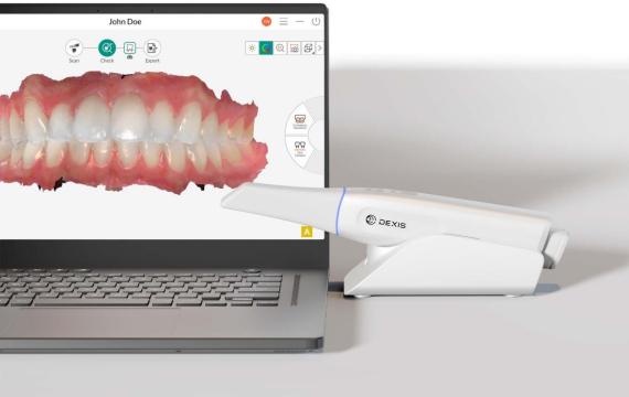 dexistrade;-imprevo-ndash;-scanner-intra-oral-nouvelle-geacute;neacute;ration